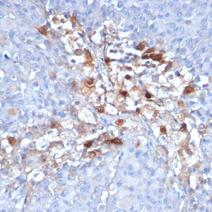 MCAM (Melanoma Cell Adhesion) / MUC18 / CD146; Clone C146/634 (Concentrate)